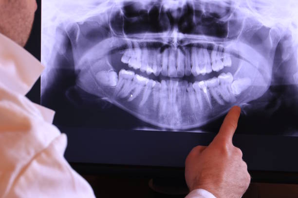 Best Tooth Infection Emergency Dentist  in Kearney Park, MS