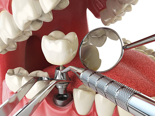 Best Broken Tooth Emergency  in Kearney Park, MS